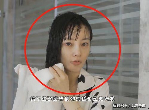 张凯毅爆料整容视频大全,视频大全曝光惊人变化