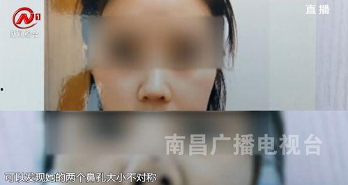 南昌医美爆料事件视频曝光,揭秘行业乱象与患者权益受损 第3张 南昌医美爆料事件视频曝光,揭秘行业乱象与患者权益受损 第3张